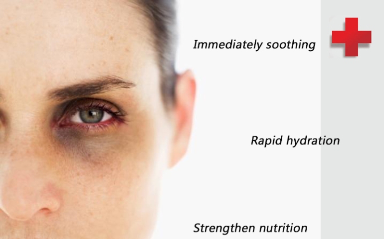 Eye-Care-Tips-Women-Skincare-Face-Dark-Circle