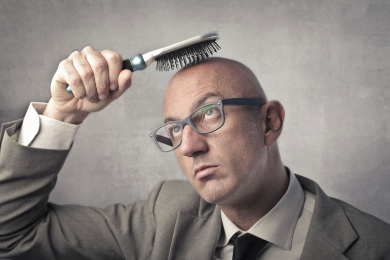 Abnormal-hair-loss-hair-fall-bald-bare-hair-man-Glamfields-blog